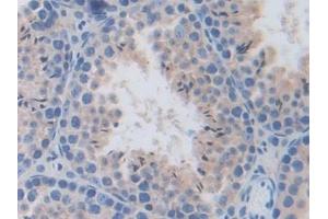 Immunohistochemistry (IHC) image for anti-Heparanase (HPSE) (AA 353-464) antibody (ABIN7438439)