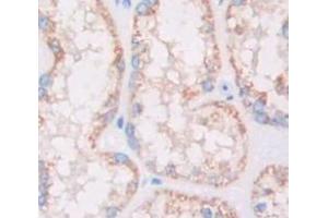 Used in DAB staining on fromalin fixed paraffin- embedded Kidney tissue (HSD17B12 Antikörper  (AA 1-312))