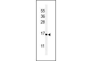 RPS25 Antikörper  (N-Term)