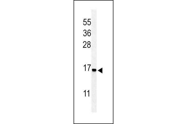 RPS25 Antikörper  (N-Term)