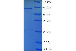 SDS-PAGE (SDS) image for Tumor Protein P53 (TP53) (AA 1-387), (full length) protein (His-SUMO Tag) (ABIN5710532) (p53 Protein (AA 1-387, full length) (His-SUMO Tag))