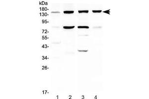 Western blot testing of 1) human HeLa, 2) human HepG2, 3) rat liver and 4) mouse liver lysate with ITGA5 antibody at 0. (ITGA5 Antikörper)