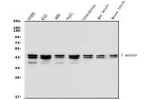 Western blot analysis of hnRNP D/AUF1/HNRNPD using anti-hnRNP D/AUF1/HNRNPD antibody (ABIN7602592). (HNRNPD/AUF1 Antikörper  (AA 88-246))