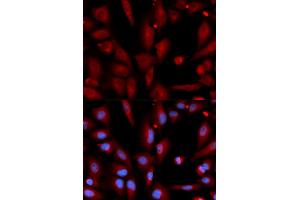 Immunofluorescence analysis of U2OS cells using WIF1 antibody (ABIN5973119). (WIF1 Antikörper)