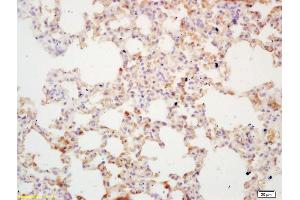 Formalin-fixed and paraffin embedded mouse lung labeled with Rabbit Anti DcR1 Polyclonal Antibody, Unconjugated  at 1:200 followed by conjugation to the secondary antibody and DAB staining (DcR1 Antikörper  (AA 51-150))