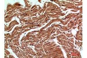 Immunohistochemistry (IHC) analysis of paraffin-embedded Human Heart, antibody was diluted at 1:100. (CD59 Antikörper  (Internal Region))