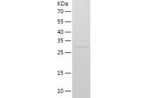 SUV39H1 Protein (AA 82-412) (His tag)