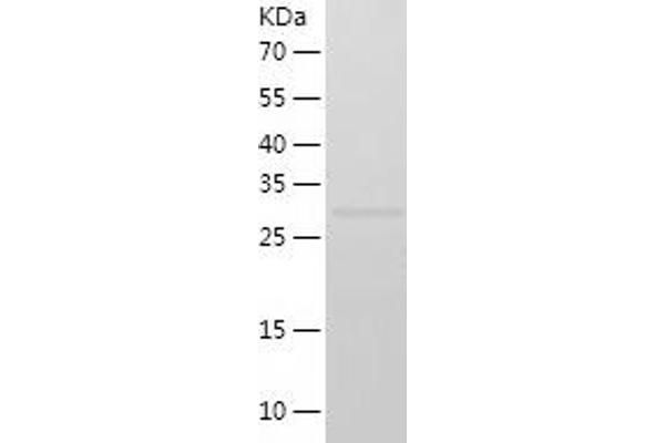 SUV39H1 Protein (AA 82-412) (His tag)