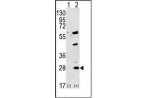 Western blot analysis of GREM1 (arrow) using Gremlin-1 / GREM1 Antibody (C-term) Cat. (GREM1 Antikörper  (C-Term))