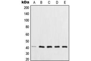 Western blot analysis of XPA expression in HCT116 (A), HeLa (B), HepG2 (C), MCF7 (D), NIH3T3 (E) whole cell lysates.