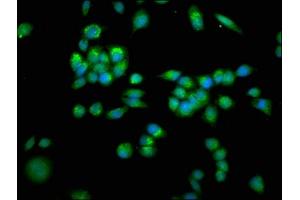 Immunofluorescence (IF) image for anti-Solute Carrier Family 25 (Mitochondrial Carrier, Adenine Nucleotide Translocator), Member 4 (SLC25A4) (AA 40-74) antibody (ABIN7143534)