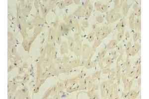 Immunohistochemistry of paraffin-embedded human heart tissue using ABIN7175069 at dilution of 1:100 (C2orf27A Antikörper  (AA 3-174))