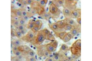 Used in DAB staining on fromalin fixed paraffin-embedded Liver tissue (BCL3 Antikörper  (AA 82-341))