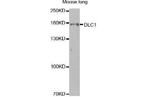 Western Blotting (WB) image for anti-Deleted in Liver Cancer 1 (DLC1) antibody (ABIN1872283) (DLC1 Antikörper)