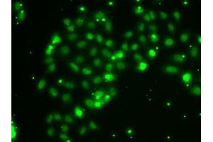 Immunofluorescence analysis of A-549 cells using TXNL4B antibody (ABIN6133086, ABIN6149739, ABIN6149740 and ABIN6222926). (TXNL4B Antikörper  (AA 1-149))