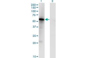 Western Blot analysis of MKNK1 expression in transfected 293T cell line by MKNK1 monoclonal antibody (M05), clone 5E2. (MKNK1 Antikörper  (AA 1-465))