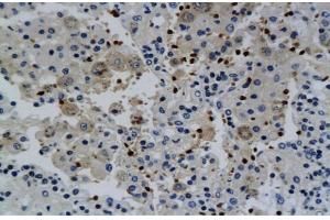 Immunohistochemistry (IHC) image for anti-Interferon gamma (IFNG) (AA 81-166) antibody (ABIN669141) (Interferon gamma Antikörper  (AA 81-166))
