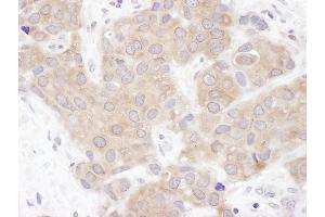 anti-Valosin Containing Protein (p97)/p47 Complex Interacting Protein 1 (Vcpip1) (AA 1100-1150) antibody