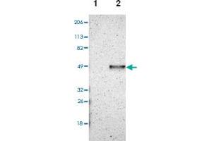 Western blot analysis of Lane 1: Human cell line RT-4, Lane 2: Human cell line U-251MG sp with CADM3 polyclonal antibody . (CADM3 Antikörper)