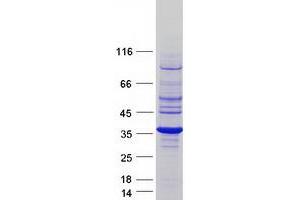Western Blotting (WB) image for Ras-Related GTP Binding A (RRAGA) protein (Myc-DYKDDDDK Tag) (ABIN2731191)