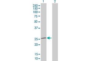 Western Blot analysis of SOD2 expression in transfected 293T cell line by SOD2 MaxPab polyclonal antibody. (SOD2 Antikörper  (AA 1-222))