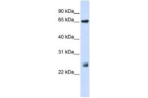 WB Suggested Anti-TRIM8 Antibody Titration:  0. (TRIM8 Antikörper  (N-Term))