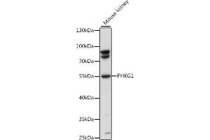 Western blot analysis of extracts of mouse kidney, using PHKG1 antibody (ABIN7269368) at 1:1000 dilution. (PHKG1 Antikörper  (AA 245-350))