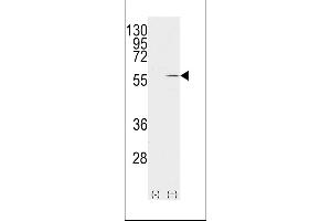 Western Blotting (WB) image for anti-Vimentin (VIM) (AA 63-90) antibody (ABIN389211)