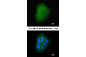 ICC/IF Image Immunofluorescence analysis of paraformaldehyde-fixed A431, using Transmembrane protein 147, antibody at 1:200 dilution. (TMEM147 Antikörper)