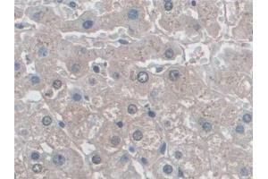 Immunohistochemistry (IHC) image for anti-Myosin Heavy Chain 7, Cardiac Muscle, beta (MYH7) (AA 26-309) antibody (ABIN7440755)