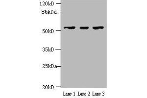 Western blot All lanes: IFIT5 antibody at 2 μg/mL Lane 1: A375 whole cell lysate Lane 2: Jurkat whole cell lysate Lane 3: HepG2 whole cell lysate Secondary Goat polyclonal to rabbit IgG at 1/10000 dilution Predicted band size: 56, 51 kDa Observed band size: 56 kDa (IFIT5 Antikörper  (AA 107-320))