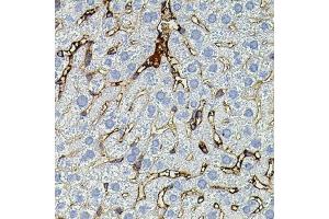 Immunohistochemistry of paraffin-embedded mouse liver using MMP9 antibody (ABIN4904401) at dilution of 1:100 (40x lens). (MMP 9 Antikörper)