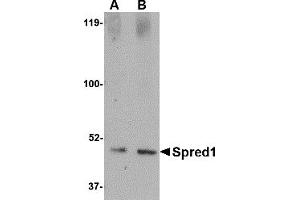 Western Blotting (WB) image for anti-Sprouty-Related, EVH1 Domain Containing 1 (SPRED1) (Middle Region 2) antibody (ABIN1031204)