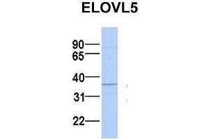 Host:  Rabbit  Target Name:  ELOVL5  Sample Type:  MCF7  Antibody Dilution:  1. (ELOVL5 Antikörper  (N-Term))
