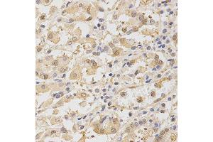 Immunohistochemistry of paraffin-embedded human stomach using TOLLIP antibody at dilution of 1:200 (x400 lens) (TOLLIP Antikörper  (AA 1-274))