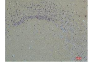 Immunohistochemistry (IHC) analysis of paraffin-embedded Rat Brain Tissue using Glutamate Receptor 1 Rabbit Polyclonal Antibody diluted at 1:200. (Glutamate Receptor 1 Antikörper)