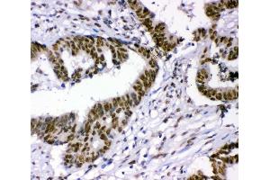 IHC analysis of p95 NBS1 using anti-p95 NBS1 antibody (ABIN3043282). (Nibrin Antikörper  (C-Term))