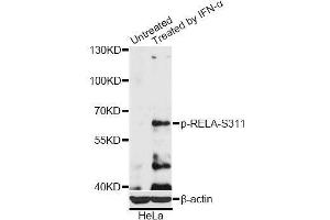 Western blot analysis of extracts of HeLa cells, using Phospho-RELA-S311 antibody (ABIN5969962) at 1/2000 dilution. (NF-kB p65 Antikörper  (pSer311))