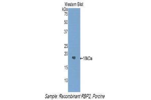 Western Blotting (WB) image for anti-Retinol Binding Protein 2, Cellular (RBP2) (AA 1-134) antibody (ABIN1860412) (RBP2 Antikörper  (AA 1-134))