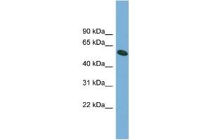 WB Suggested Anti-OMA1 Antibody Titration: 0. (OMA1 Antikörper  (Middle Region))