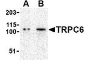 Western blot analysis of TRPC6 in K562 cell lysate with this product at (A) 0. (TRPC6 Antikörper  (N-Term))