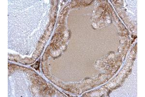 IHC-P Image alpha 1a Adrenergic Receptor antibody detects alpha 1a Adrenergic Receptor protein at cytosol on mouse prostate by immunohistochemical analysis. (alpha 1 Adrenergic Receptor Antikörper)