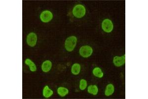Immunocytochemistry stain of Hela using CDX2 mouse mAb (1:100).