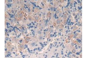 DAB staining on IHC-P; Samples: Mouse Ovary Tissue (CYP11A1 Antikörper  (AA 329-526))