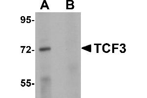 Western Blotting (WB) image for anti-Transcription Factor 3 (E2A Immunoglobulin Enhancer Binding Factors E12/E47) (TCF3) (N-Term) antibody (ABIN1031605) (TCF3 Antikörper  (N-Term))