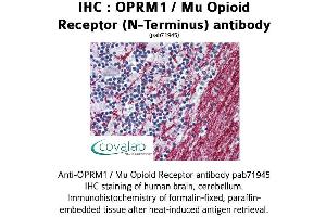 Image no. 1 for anti-Opioid Receptor, mu 1 (OPRM1) (N-Term) antibody (ABIN1737658) (Mu Opioid Receptor 1 Antikörper  (N-Term))