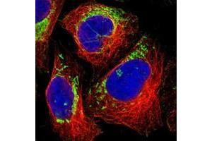 Immunofluorescent staining of human cell line U-2 OS with MRPL45 polyclonal antibody  at 1-4 ug/mL dilution shows positivity in mitochondria. (MRPL45 Antikörper)