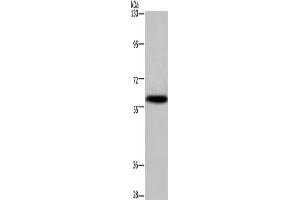 Western Blotting (WB) image for anti-Potassium Voltage-Gated Channel, Subfamily G, Member 4 (Kcng4) antibody (ABIN2433243)