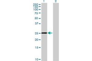 Western Blot analysis of FAM9C expression in transfected 293T cell line by FAM9C MaxPab polyclonal antibody. (FAM9C Antikörper  (AA 1-166))