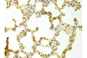 Immunohistochemistry of paraffin-embedded rat lung using HNRNPK Antibody. (HNRNPK Antikörper  (AA 1-280))